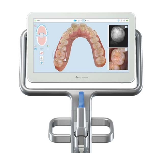 Itero Wellness Scanner | Harmony Family Dental Care | Springbank General and Family Dentist